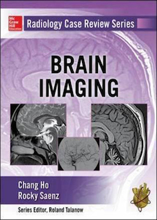 عکس Radiology Case Review Series: Brain Imaging 1st Edition