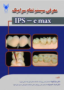 عکس معرفی سیستم تمام سرامیک IPS - e max