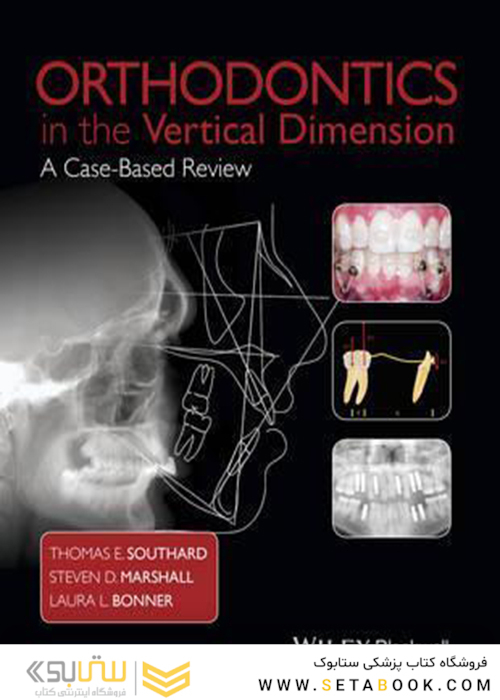 Orthodontics in the Vertical Dimension