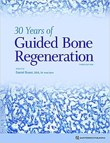 عکس 30Years of Guided Bone Regeneration in Implant Dentistry