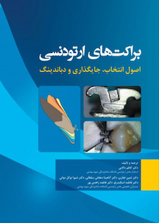 عکس براکت های ارتودنسی اصول انتخاب، جایگذاری و دباندینگ