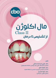 عکس مال اکلوژن Class II؛ از تشخیص تا درمان