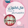 مال اکلوژن Class II؛ از تشخیص تا درمان