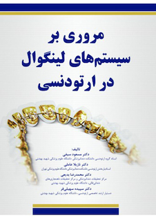 عکس مروری بر سیستم های لینگوال در ارتودنسی