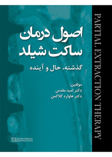 عکس اصول درمان ساکت شیلد گذشته حال و آینده