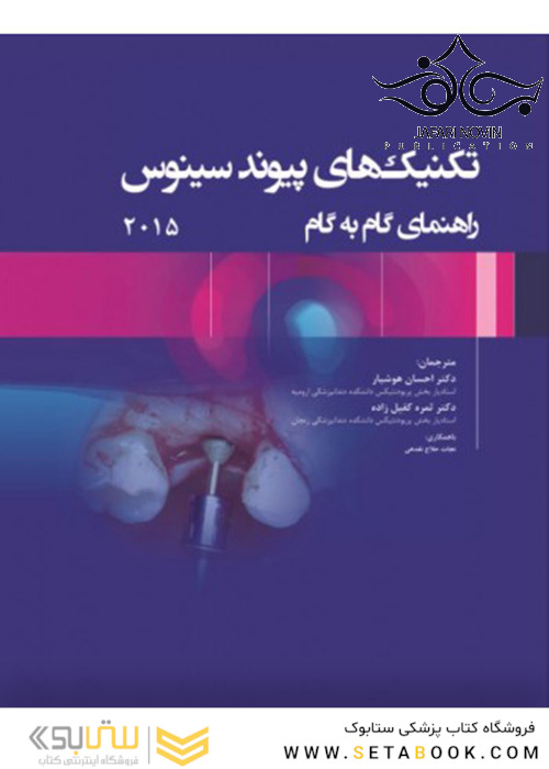 تکنیک‌های پیوند سینوس راهنمای گام به گام 2015