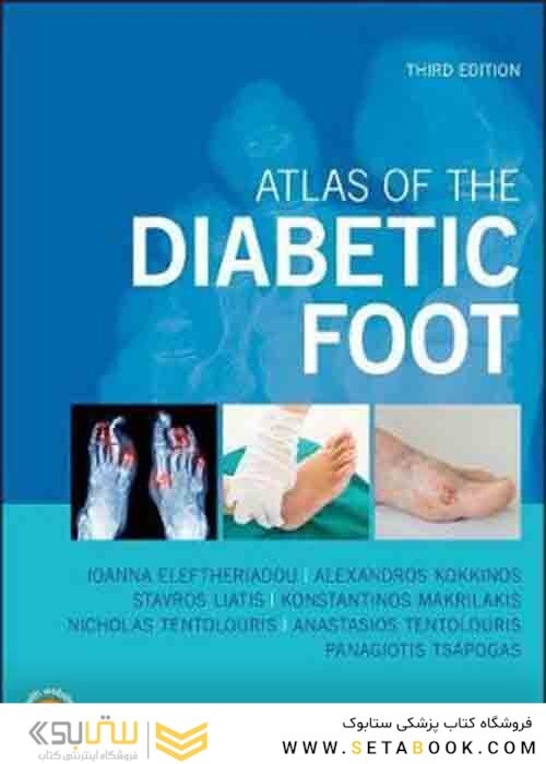 Atlas of the Diabetic Foot 3rd Edition