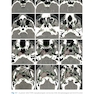 Target Volume Delineation and Field Setup : A Practical Guide for Conformal and Intensity-Modulated Radiation Therapy