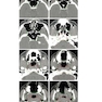 Target Volume Delineation and Field Setup : A Practical Guide for Conformal and Intensity-Modulated Radiation Therapy