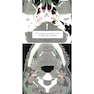Target Volume Delineation and Field Setup : A Practical Guide for Conformal and Intensity-Modulated Radiation Therapy