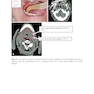 Target Volume Delineation and Field Setup : A Practical Guide for Conformal and Intensity-Modulated Radiation Therapy