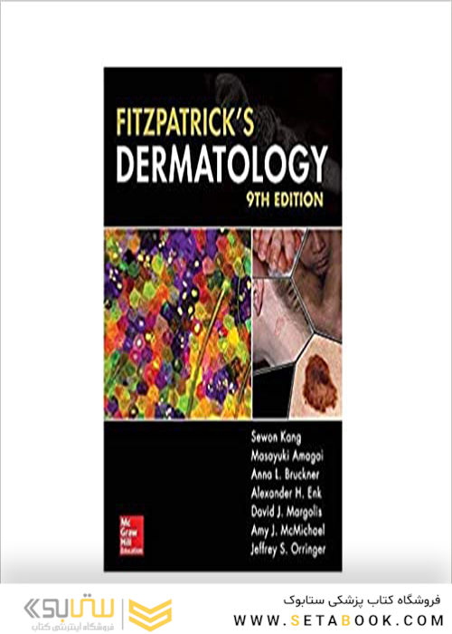 Fitzpatrick