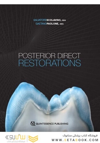 Posterior Direct Restorations 1st Edition