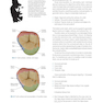 Posterior Direct Restorations 1st Edition