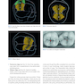 Posterior Direct Restorations 1st Edition