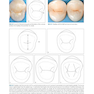 Posterior Direct Restorations 1st Edition