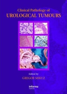 عکس Clinical Pathology of Urological Tumours2007