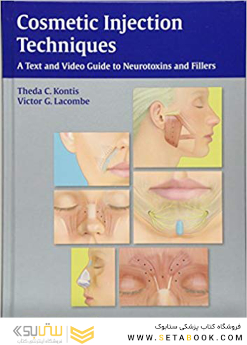 Cosmetic Injection Techniques