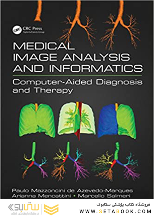 Medical Image Analysis and Informatics: Computer-Aided Diagnosis and Therapy 1st Edición