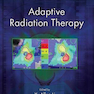 Adaptive Radiation Therapy (Imaging in Medical Diagnosis and Therapy) 1st Edición