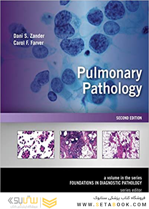 Pulmonary Pathology : A Volume in Foundations in Diagnostic Pathology Series 2nd Edición