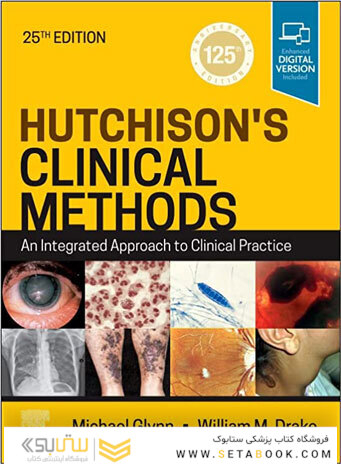 Hutchison