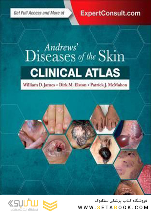 Andrews
