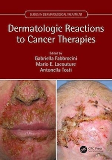 عکس Dermatologic Reactions to Cancer Therapies2019واکنشهای پوستی به درمانهای سرطان