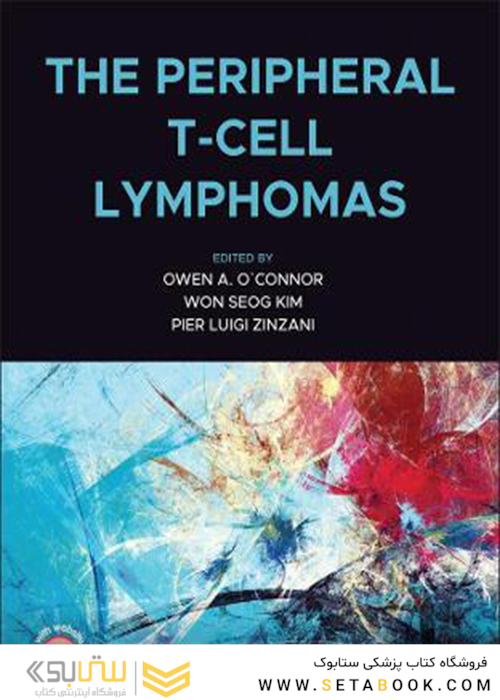 The Peripheral T-Cell Lymphomas2021لنفوم های سلول T محیطی