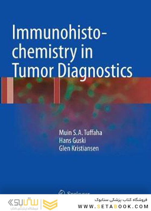 Immunohistochemistry in Tumor Diagnostics 1st ed. 2018 Edition
