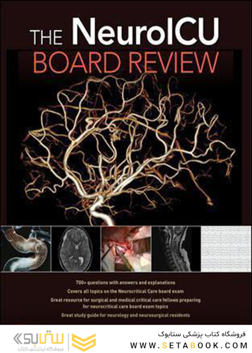 The NeuroICU Board Review 1st Edition2018