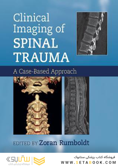 Clinical Imaging of Spinal Trauma 1st Edition2018تصویربرداری بالینی ترومای نخاعی ویرایش اول
