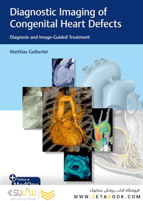 Diagnostic Imaging of Congenital Heart Defects: Diagnosis and Image-Guided Treatment