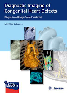عکس Diagnostic Imaging of Congenital Heart Defects: Diagnosis and Image-Guided Treatment