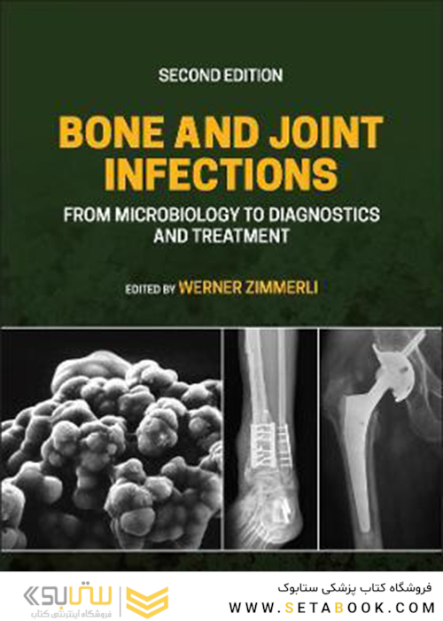 2021 Back to results  Bone and Joint Infections: From Microbiology to Diagnostics and Treatment 2nd Edition