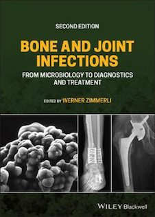 عکس 2021 Back to results  Bone and Joint Infections: From Microbiology to Diagnostics and Treatment 2nd Edition