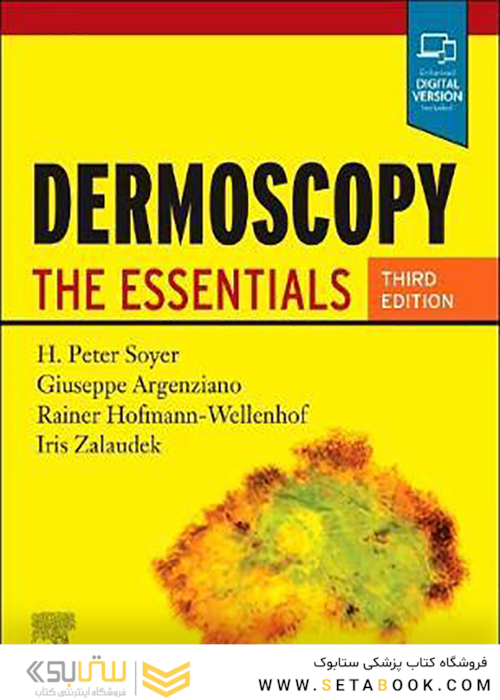 Dermoscopy: The Essentials, 3rd Edition