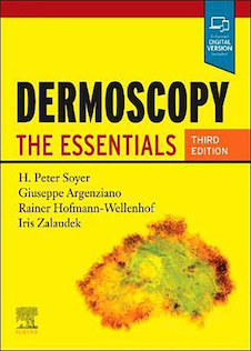 عکس Dermoscopy: The Essentials, 3rd Edition