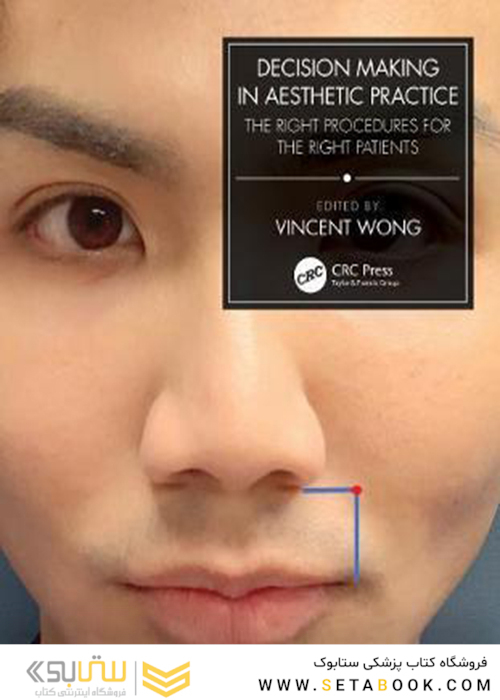 Decision Making in Aesthetic Practice: The Right Procedures for the Right Patients2021تصمیم گیری در عمل زیبایی: روش های مناسب برای بیماران