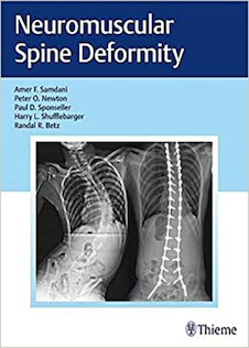 عکس Neuromuscular Spine Deformity 1st Edition2018 تغییر شکل عضله عصبی عضلانی