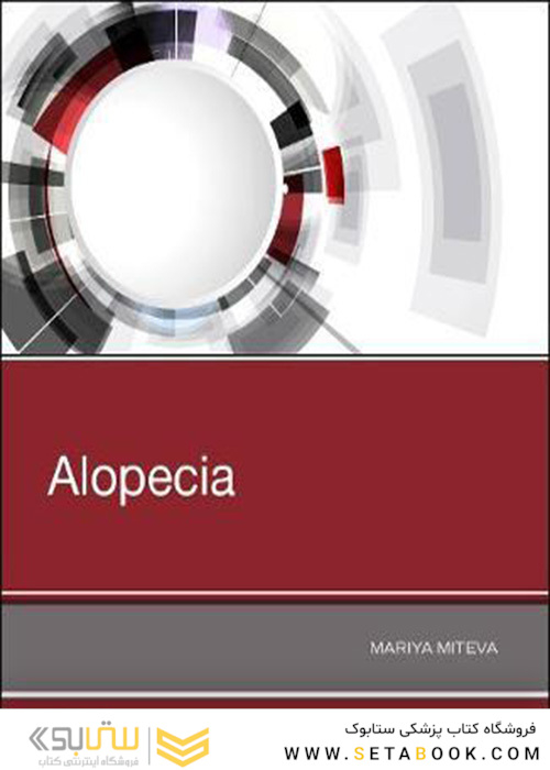 Alopecia