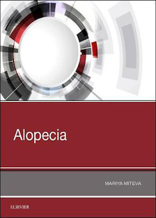 عکس Alopecia