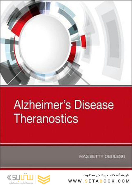 Alzheimer