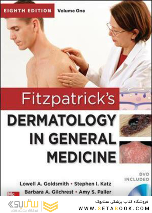 Fitzpatrick