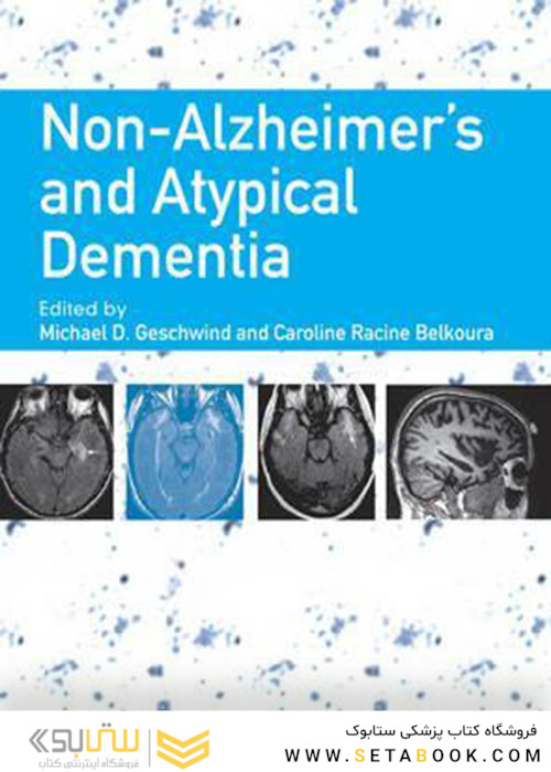 Non-Alzheimer