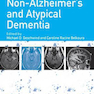 Non-Alzheimer