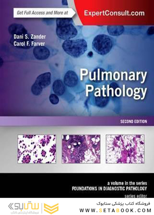 Pulmonary Pathology : A Volume in the Series: Foundations in Diagnostic Pathology