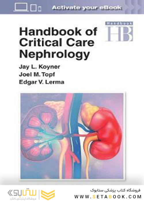 Handbook of Critical Care Nephrology