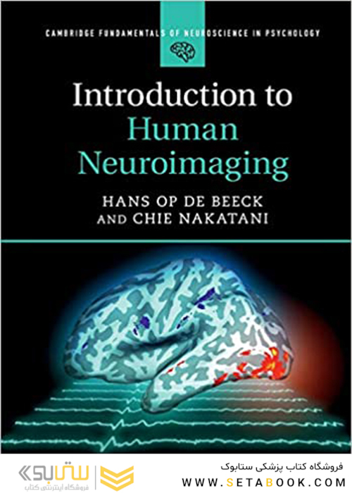 Introduction to Human Neuroimaging (Cambridge Fundamentals of Neuroscience in Psychology)