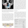 Perspectives on Zygomatic Implants, An Issue of Atlas of the Oral & Maxillofacial Surgery Clinics: Volume 29-2